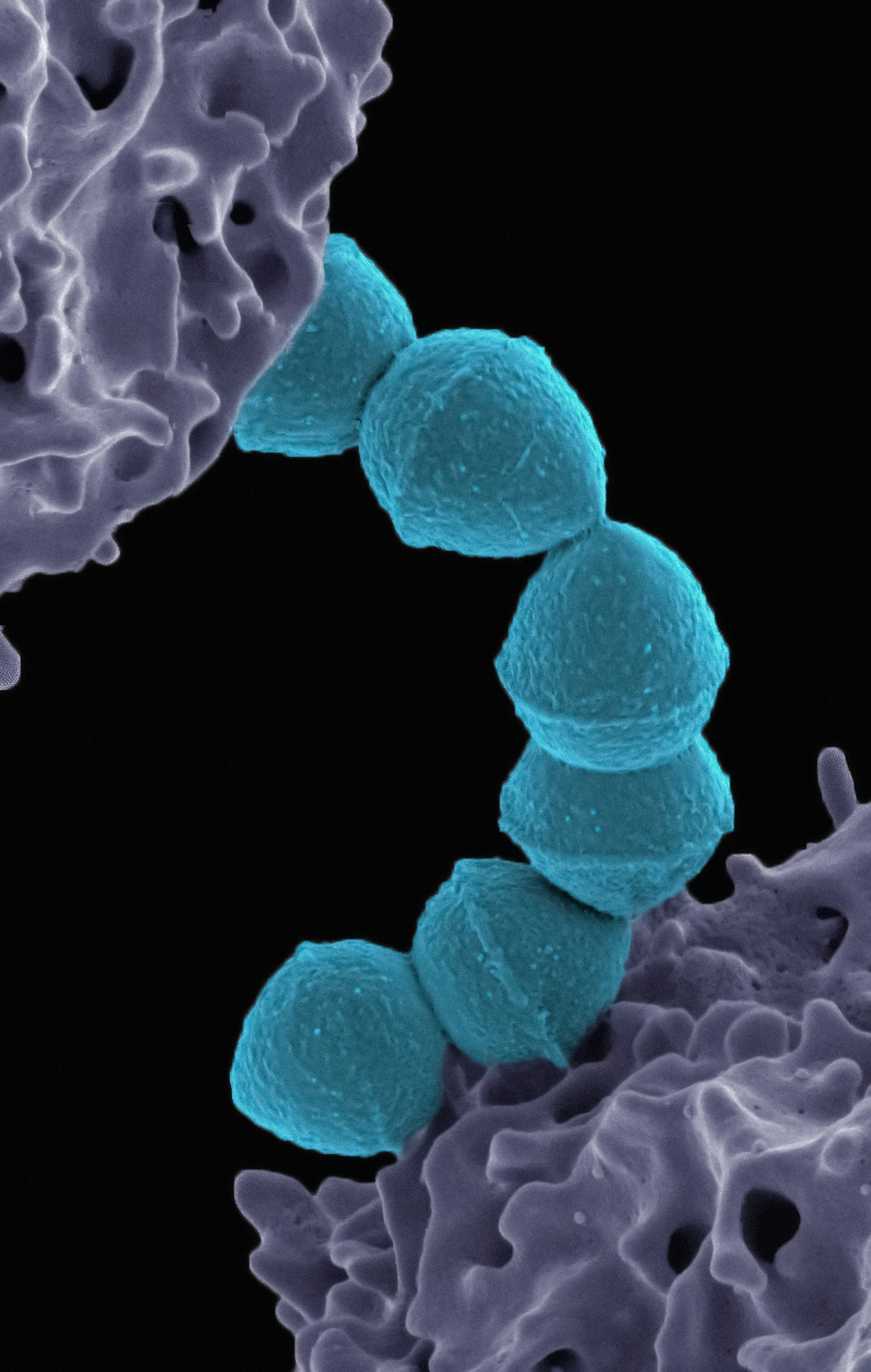 Des méthodes performantes de contrôle des phages à l&rsquo;usine